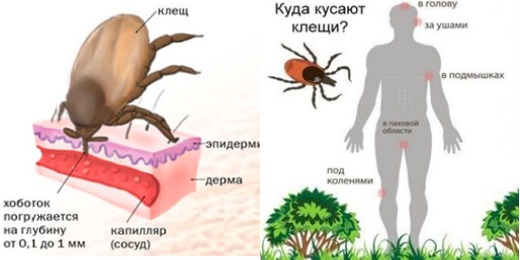Актуальная информация по профилактике инфекций, передаваемых иксодовыми клещами
